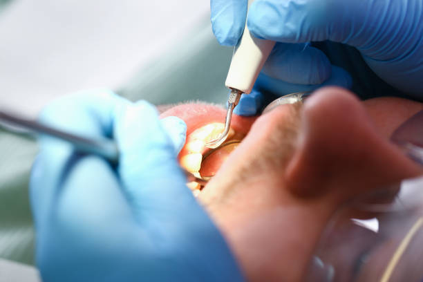 Best Pediatric Emergency Dentist in Jonesville, NC