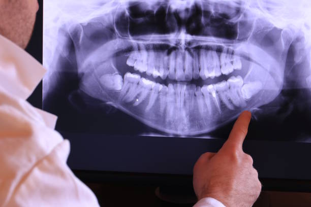Best Orthodontic Emergency Dentist in Jonesville, NC